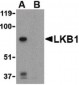 STK11 / LKB1 Antibody (N-Terminus)