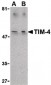 TIMD4 / TIM4 / TIM-4 Antibody (C-Terminus)