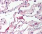 TLR6 Antibody (Internal)