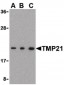 TMED10 / TMP21 Antibody (C-Terminus)