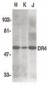 TNFRSF10A / DR4 Antibody