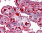 TNFRSF12A / FN14 Antibody