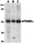 TRIM5 Antibody