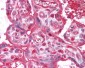 LPP3 / PPAP2B Antibody