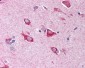 HSPA9 / Mortalin / GRP75 Antibody (N-Terminus)