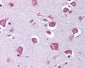 RELA / NFKB p65 Antibody (phospho-Ser529)