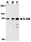 TLR9 Antibody (Internal)