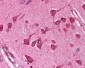 NFKBIA / IKB Alpha / IKBA Antibody (C-Terminus)
