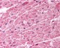 TICAM1 / TRIF Antibody (C-Terminus)