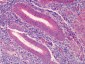 PDGFRA / PDGFR Alpha Antibody (aa1063-1077)