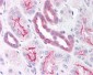 Pyrin / MEFV / MEF Antibody (aa268-284)