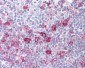AKT1 Antibody (phospho-Ser473)