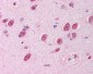 AKT1 Antibody (phospho-Thr308)