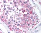 BCAP31 / BAP31 Antibody (Internal)