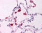 IFN Beta / Interferon Beta Antibody (Internal)