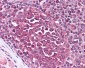 IRAK3 / IRAKM / IRAK-M Antibody (C-Terminus)