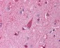 TLR8 Antibody