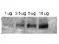 ABCB1 / MDR1 / P Glycoprotein Antibody (aa262-277)
