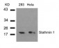 STMN1 / Stathmin / LAG Antibody (Ser37)