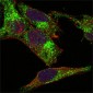 INHA / Inhibin Alpha Antibody
