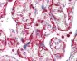 INHA / Inhibin Alpha Antibody
