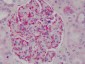 NFKBIA / IKB Alpha / IKBA Antibody (C-Terminus)