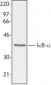 NFKBIA / IKB Alpha / IKBA Antibody (C-Terminus)