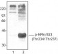 NPM1 / NPM / Nucleophosmin Antibody (phospho-Thr234/Thr237)