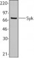 SYK Antibody (aa5-360, clone SYK-01)