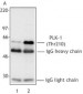 PLK1 / PLK-1 Antibody (phospho-Thr210, clone 2A3)