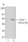 PLK1 / PLK-1 Antibody (phospho-Thr210, clone 2A3)