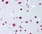 SAFB1 / SAFB Antibody (aa345-357, clone 6F7)
