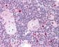 AIRE Antibody (Internal)