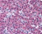 RIPK3 / RIP3 Antibody (aa480-530)
