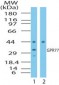 C5AR2 / GPR77 / C5L2 Antibody (aa1-50)