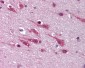 MAPK9 / JNK2 / SAPK Antibody (C-Terminus)