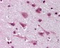 MAPK9 / JNK2 / SAPK Antibody (N-Terminus)