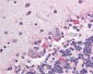 PLAP / Alkaline Phosphatase Antibody (clone H7E8)