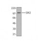 SIK2 / SNF1LK2 Antibody (clone S15G10)