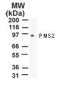 PMS2 Antibody (aa623-639, clone 163C1251)