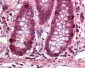PRDM5 Antibody (aa100-200)