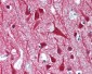GCN2 Antibody