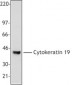 KRT19 / CK19 / Cytokeratin 19 Antibody (clone A53-B/A2)