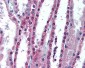 APIP Antibody