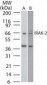IRAK2 / IRAK-2 Antibody