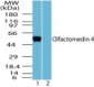 OLFM4 / Olfactomedin 4 Antibody (aa400-450)