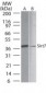 SIRT7 / Sirtuin 7 Antibody