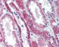 TNFRSF11A / RANK Antibody (aa603-613)