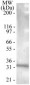 TNFRSF13B / TACI Antibody (aa116-132)