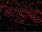 HAVCR1 / KIM-1 Antibody (N-Terminus)